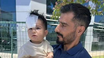 Şanlıurfa'da sahipsiz k&ouml;peğin saldırısına uğrayan &ccedil;ocuk yaralandı