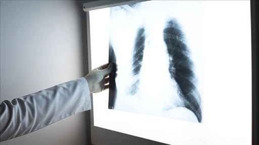 Sık yaşanan viral enfeksiyonlar akciğer kapasitesini d&uuml;ş&uuml;r&uuml;yor