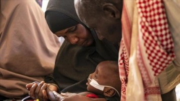 Somali'de hastaneler açlıktan ölüme sürüklenen çocuklarla dolu