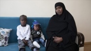 Somalili aile 'balık pulu' hastalığı nedeniyle ayrı düştü