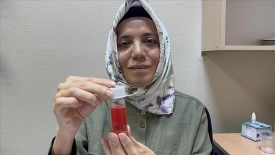 S&uuml;leyman Demirel &Uuml;niversitesi G&ouml;z Bankası 2 yılda 100'den fazla hastaya "ışık" oldu