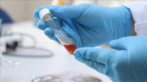 Tekirdağ'da üzüm atığından yüksek değerli tek hücre yağı üretildi