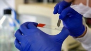 Transgenik fareler Kovid-19 aşısı ve ilaç çalışmalarını hızlandıracak