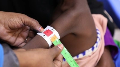 UNICEF, insani yardımların kesildiği Somali'de en b&uuml;y&uuml;k bedeli &ccedil;ocukların &ouml;dediğini bildirdi
