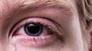Uzun süreli ekran kullanımı gözlerdeki alerjik bulguları artırıyor