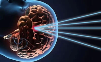 X - Gamma ve akıl hastalıkları -&Ouml;z&rsquo;&uuml;n İfadesi yazdı-