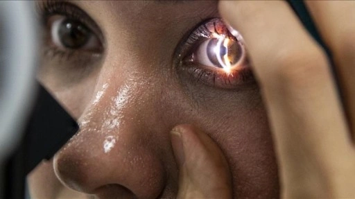 Yapay zekaya g&uuml;venilerek ihmal edilen g&ouml;z sağlığı tedaviyi zorlaştırıyor