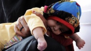 Yemen'de 5 milyonu aşkın çocuk aşılanacak