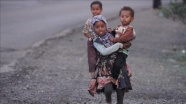 Yemen&#039;de 7 yıldır süren savaşın bedelini mülteci kamplarındaki kadın ve çocuklar ödüyor
