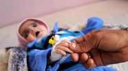 Yemen'deki ilaç sıkıntısı yeni trajedilerin habercisi