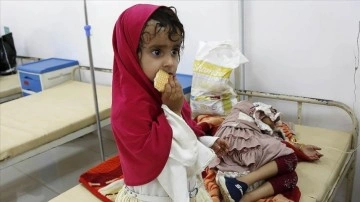 Yemen'de yarım milyon çocuğun hayatı yetersiz beslenme nedeniyle tehlikede