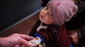 Yetersiz beslenme nedeniyle sütten kesilen Afgan annelerin bebekleri büyüyemiyor