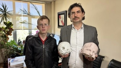 Y&uuml;zdeki şekil bozukluğu "3 boyutlu teknoloji"yle d&uuml;zeltildi